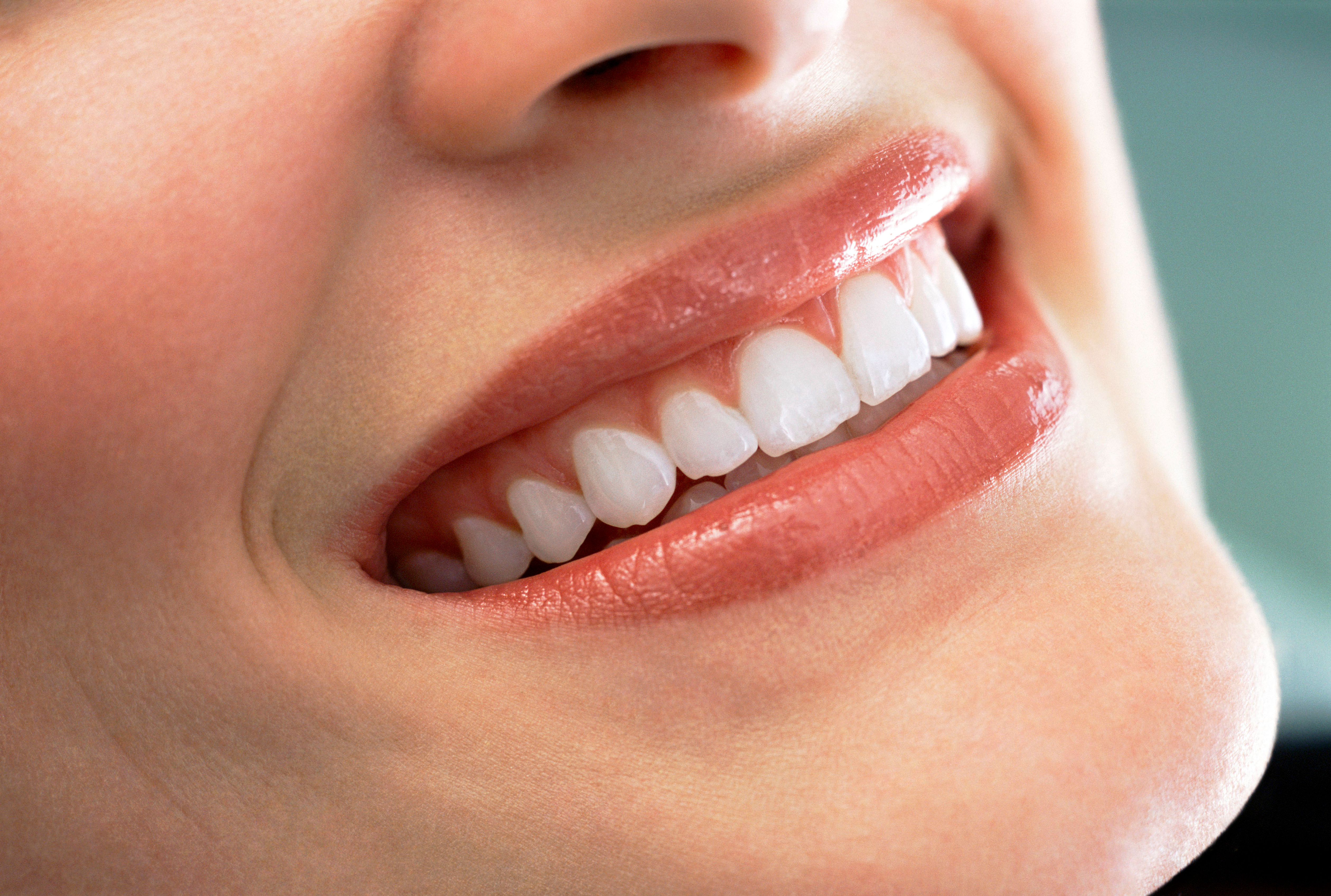 Woman with beautiful smile showing porcelain veneers results