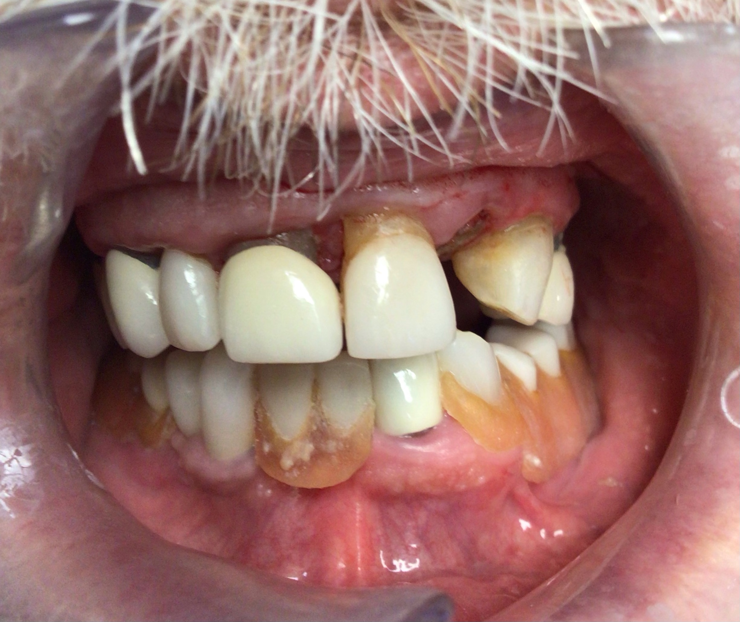 Before - Cosmetic Dentistry