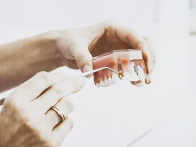 Dental professional holding a tooth replacement model while reviewing implant treatment options
