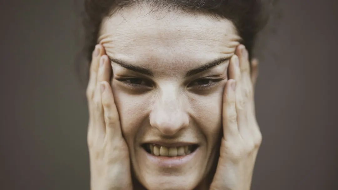 Woman pressing both hands to her jaw and temples in discomfort, a typical presentation of TMJ pain