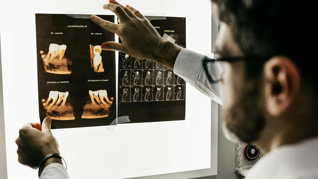 Dentist examining dental X-ray images of a tooth and jawbone structure on a lightbox