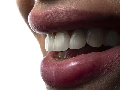 Close-up of a patient's open mouth during an urgent dental examination