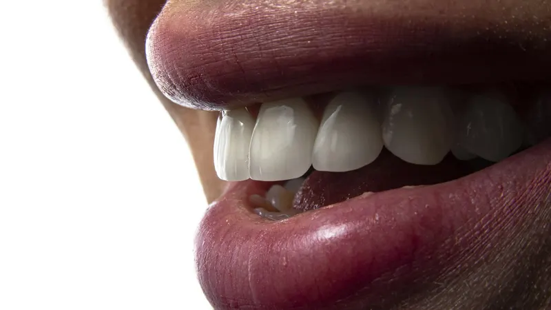 Close-up of a patient's open mouth during an urgent dental examination for a suspected abscess