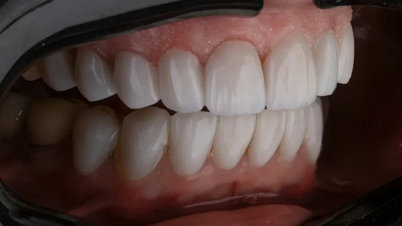 Close-up of a person's smile with straight, healthy-looking teeth