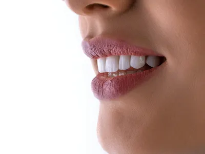 Close-up of a bright, white smile after professional teeth whitening