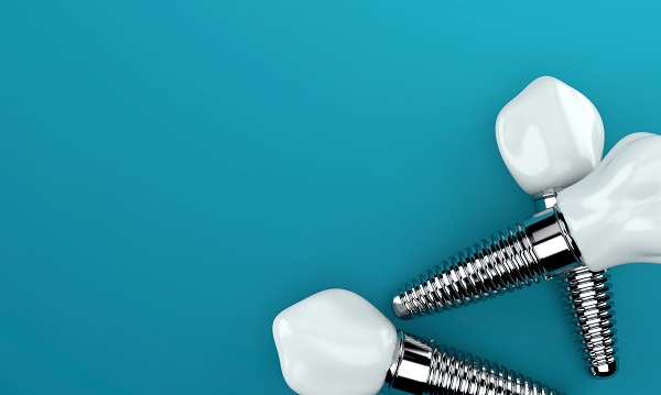 Can Dental Implants Be Removed?