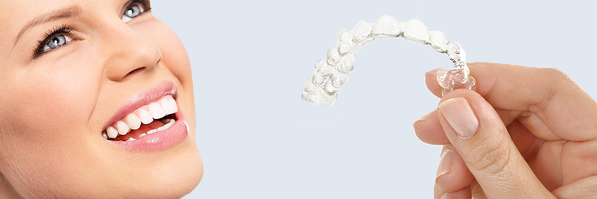 West Covina 7 Things Parents Need to Know About Invisalign Teen