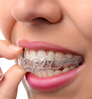 Clear Aligners - Almost Invisible Braces West Covina, CA