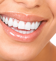 Teeth Whitening Services West Covina, CA