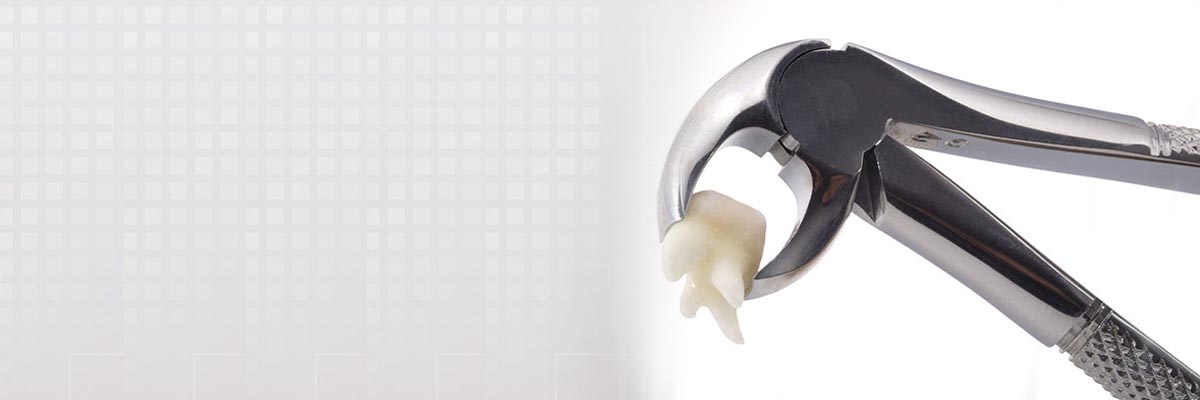 West Covina Tooth Extraction